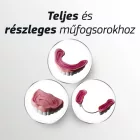 Blend-a-dent Ultimate műfogsorrögzítő krém 40 g - friss mentolos íz
